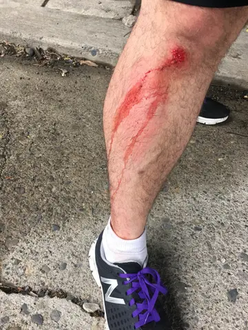zombies got me